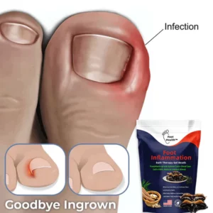 FootHealth™ Foot Inflammation Bath Therapy Gel Beads