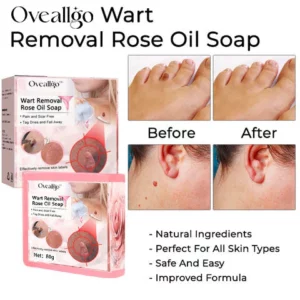 Oveallgo™ Wart NanoPURI Removal Rose Oil Soap
