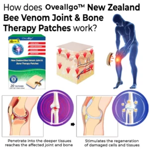 Oveallgo™ New Zealand Bee Venom Joint & Bone Therapy Patches