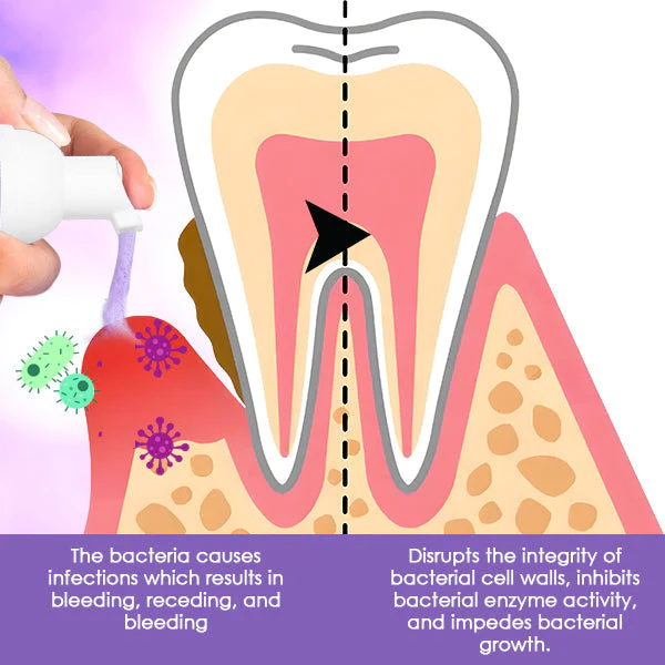 DentiCare™ Gum Treatment Foam (TEST)