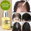KLARA™ Hair Growth Essential Oil - Reclaim Your Luscious Locks!