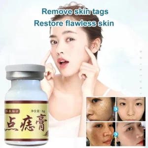 Unpree™ Concentrated Potent Skin Tag Removal Cream