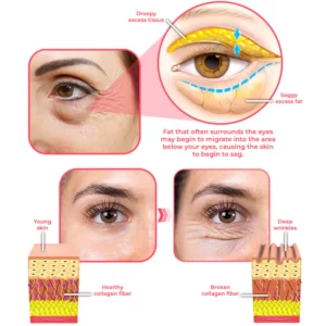 flysmus™ RadiantEyes Collagen Lifting Eye Balm Stick