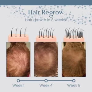 West&Month™ Root Renew Nourishing Hair Scrub