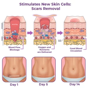 flysmus™ CelluFirmX Skin Rebound Boosting Patches