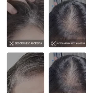 NBRIHEALTH™ NMN Scalp Cell Revitalizing Hair Essence