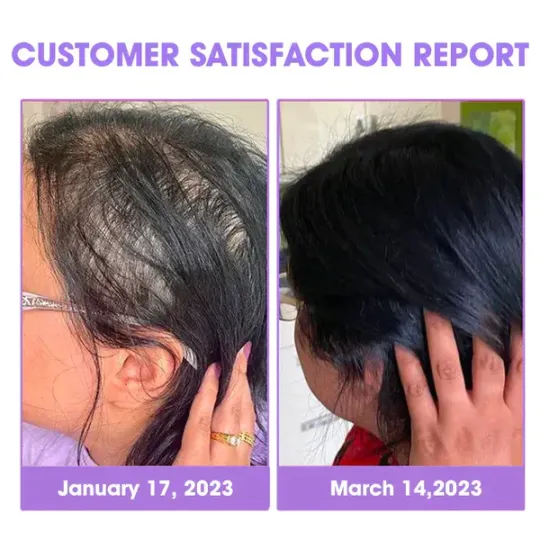 Bluesky™ Super Nourishing Hair Follicle Repair Hair Growth Drops