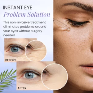 Pro-Xylane Active Anti-Wrinkle Eye Serum