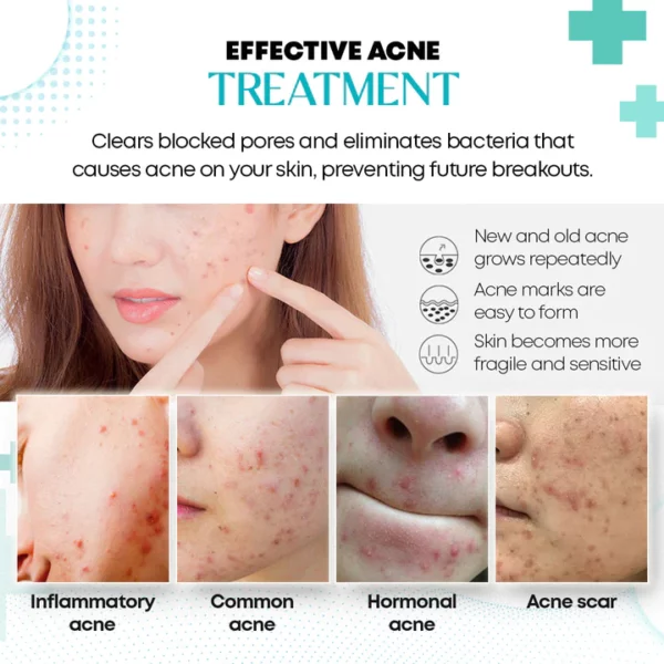 SilkenGlow™ Brighten Anti-acne Cream