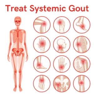 GFOUK™ IONFIR Gout Relief Wristband